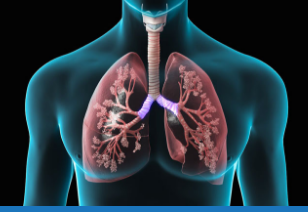 Enfisema ou Doença Pulmonar Obstrutiva crônica (DPOC)